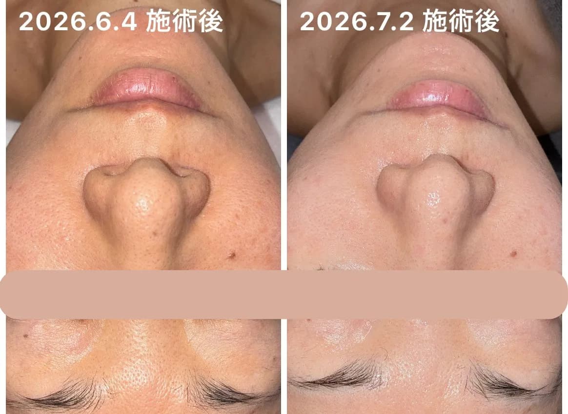 Salon Niné ｜ シミ・毛穴｜肌質改善サロン石山